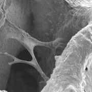 Biotech csúcssiker: befektetés előtt a Lacerta - Orthosera
